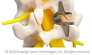 Surgical Options Panama City  spine center and neurosurgery center